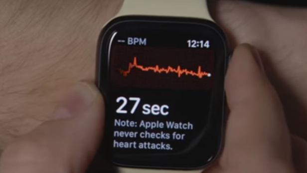 Can Apple watch ECG  detect possible signs of stroke?